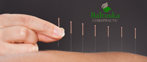 Acupuncture at Baltuska Chiropractic
